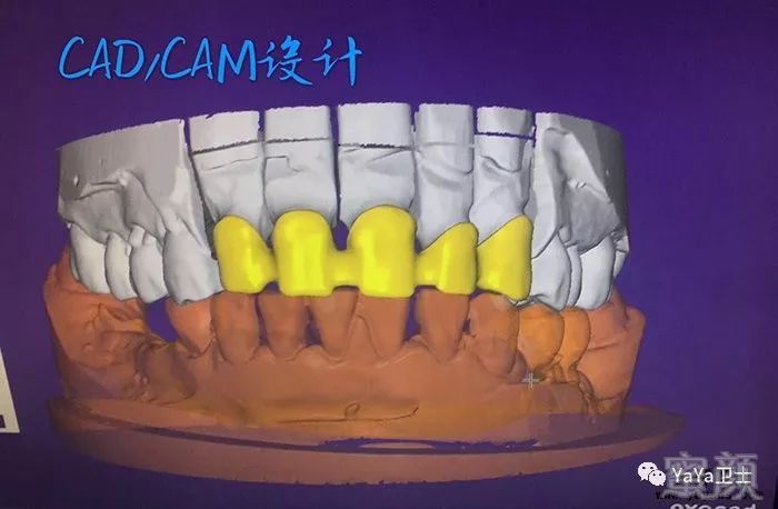 https://img.miyanlife.com/mnt/timg/180702/1354352108-3.jpg