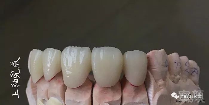 https://img.miyanlife.com/mnt/timg/180702/1354362c4-7.jpg