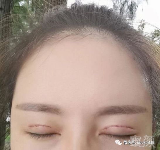 https://img.miyanlife.com/mnt/timg/180702/1355133I5-4.jpg