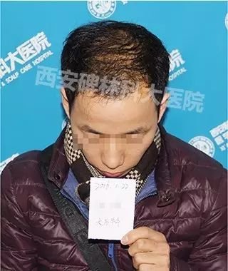 https://img.miyanlife.com/mnt/timg/180702/14240MD7-4.jpg