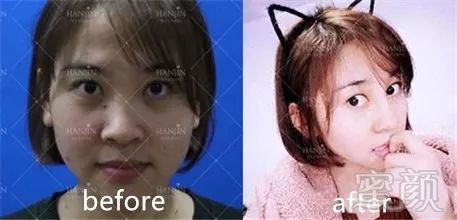 https://img.miyanlife.com/mnt/timg/180702/14493MH6-12.jpg