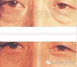 https://img.miyanlife.com/mnt/timg/180702/1513093V0-0.jpg