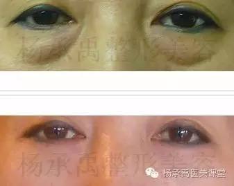 https://img.miyanlife.com/mnt/timg/180702/1513101P5-5.jpg