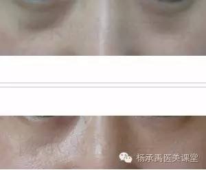 https://img.miyanlife.com/mnt/timg/180702/151310M22-2.jpg