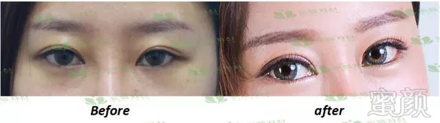 https://img.miyanlife.com/mnt/timg/180702/1513293446-5.jpg