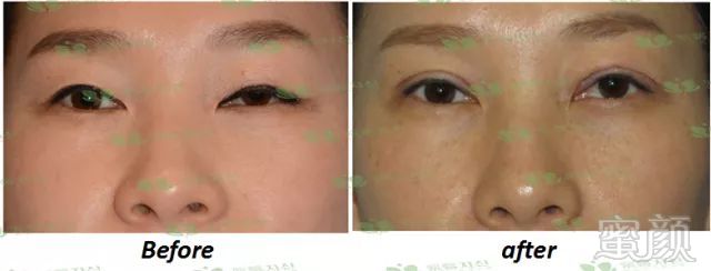 https://img.miyanlife.com/mnt/timg/180702/15132UQ3-2.jpg