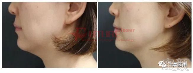 https://img.miyanlife.com/mnt/timg/180703/1101594U3-7.jpg