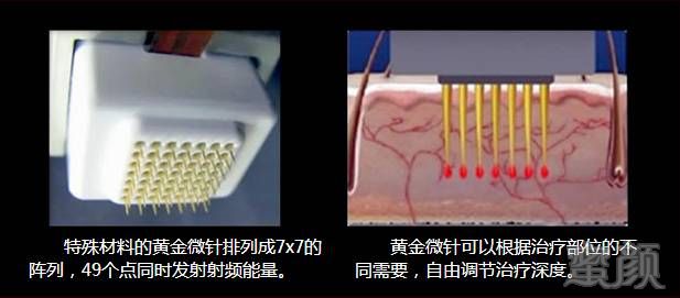 案例图片