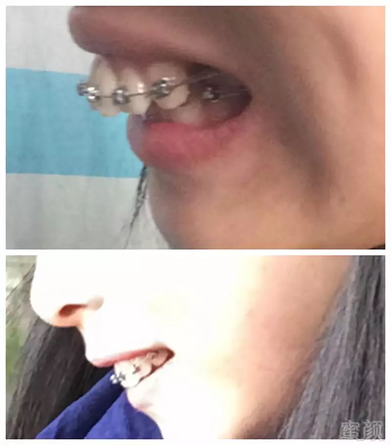 https://img.miyanlife.com/mnt/timg/180703/1124153928-0.jpg