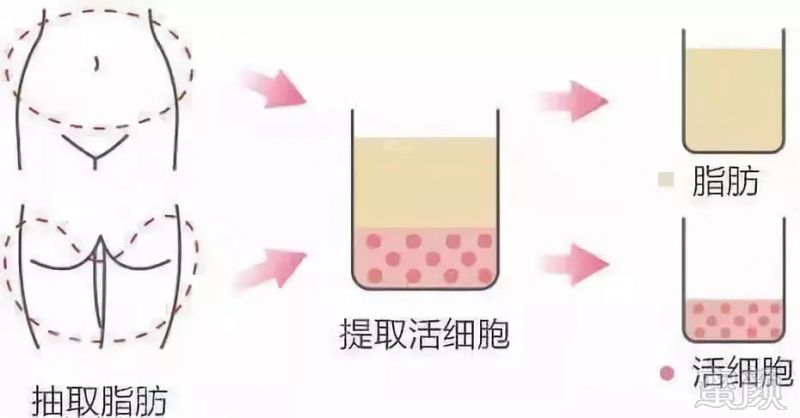 https://img.miyanlife.com/mnt/timg/180703/1125422942-11.jpg