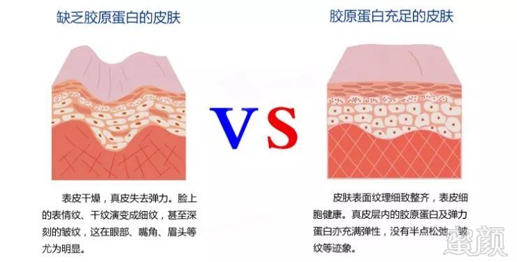 https://img.miyanlife.com/mnt/timg/180703/1125423J4-7.jpg