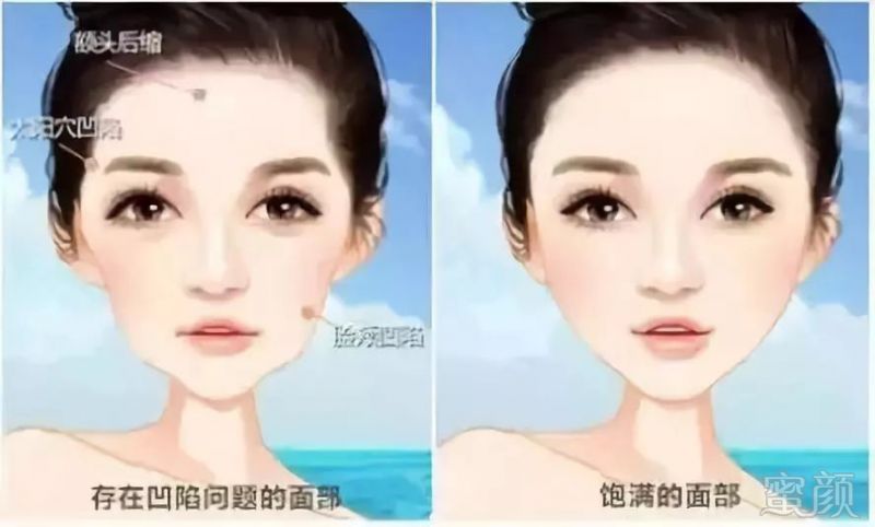 https://img.miyanlife.com/mnt/timg/180703/1125462R6-15.jpg