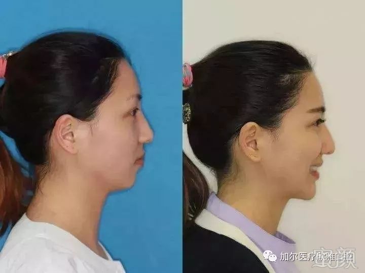 https://img.miyanlife.com/mnt/timg/180703/112J13141-3.jpg