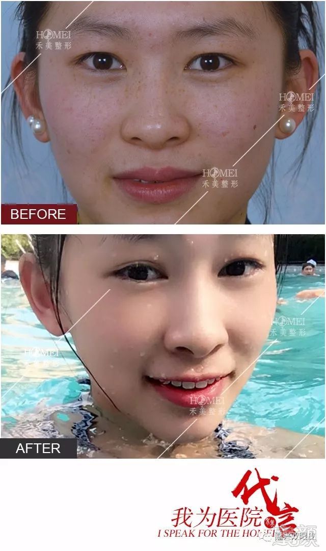 https://img.miyanlife.com/mnt/timg/180703/1134321341-1.jpg