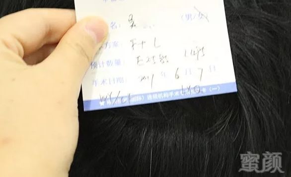 https://img.miyanlife.com/mnt/timg/180703/11363150F-1.jpg