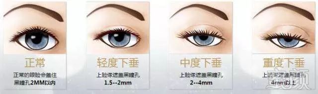 https://img.miyanlife.com/mnt/timg/180703/1142093607-5.jpg