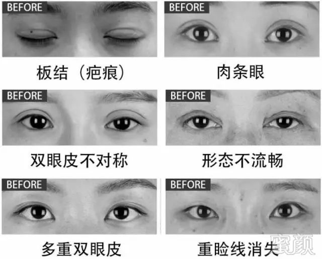 https://img.miyanlife.com/mnt/timg/180703/114320D24-0.jpg