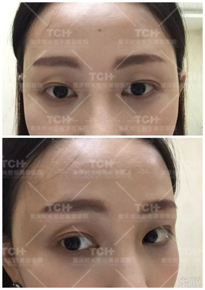 https://img.miyanlife.com/mnt/timg/180703/1143214126-1.jpg