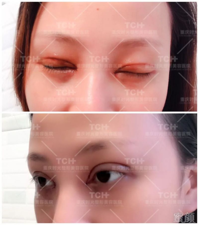 https://img.miyanlife.com/mnt/timg/180703/114323O96-2.jpg