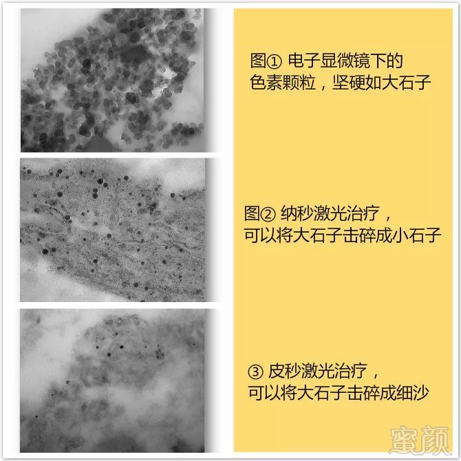 https://img.miyanlife.com/mnt/timg/180703/1202334535-10.jpg