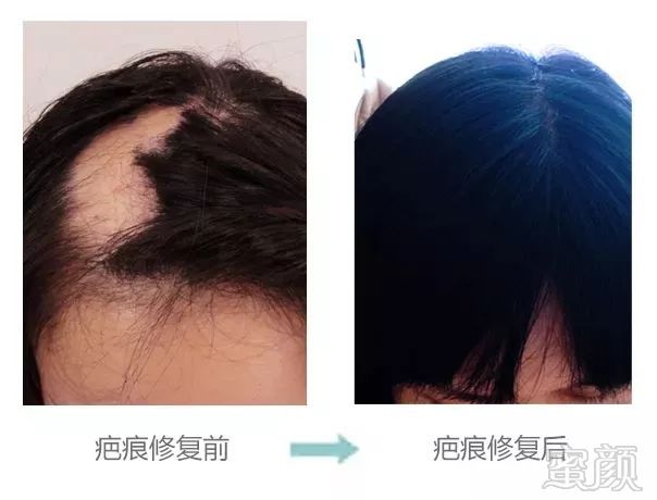 https://img.miyanlife.com/mnt/timg/180703/12024Q323-4.jpg