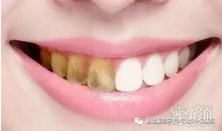 https://img.miyanlife.com/mnt/timg/180703/120SV4M-0.jpg