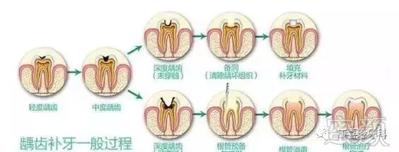 案例图片