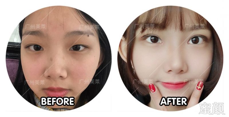 https://img.miyanlife.com/mnt/timg/180703/1232343139-6.jpg