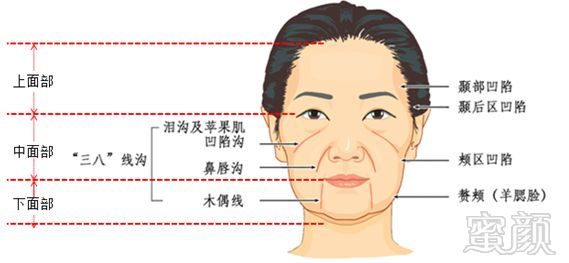 https://img.miyanlife.com/mnt/timg/180703/1235303441-9.jpg