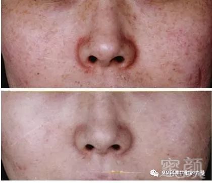 https://img.miyanlife.com/mnt/timg/180703/1236121310-1.jpg