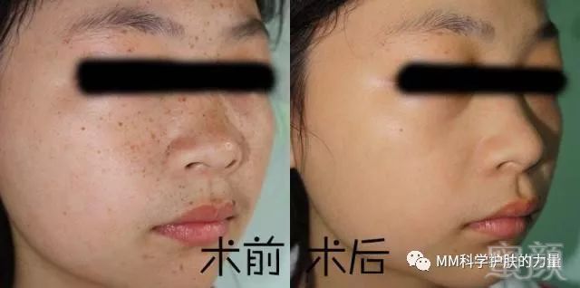 https://img.miyanlife.com/mnt/timg/180703/123612G37-0.jpg