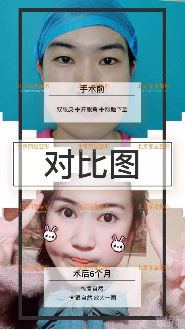 https://img.miyanlife.com/mnt/timg/180703/1255231335-0.jpg