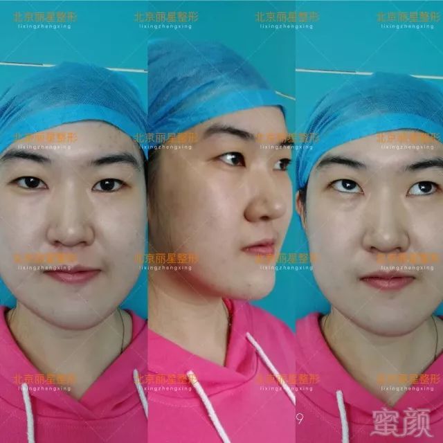 https://img.miyanlife.com/mnt/timg/180703/1255242635-2.jpg