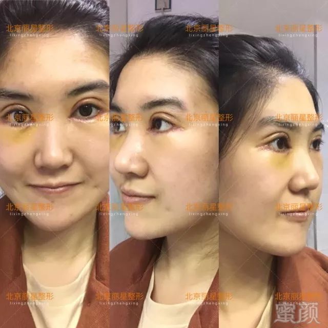 https://img.miyanlife.com/mnt/timg/180703/1255244015-3.jpg