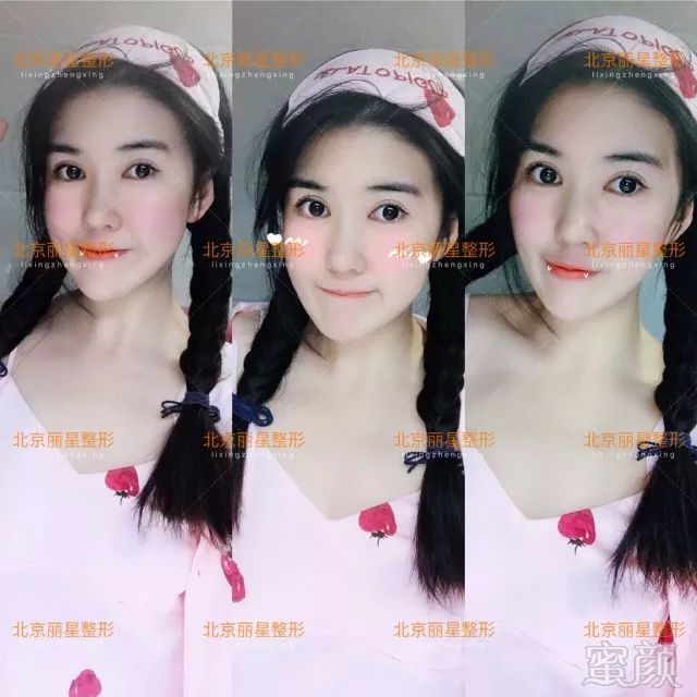 https://img.miyanlife.com/mnt/timg/180703/1255252A8-6.jpg