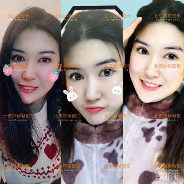https://img.miyanlife.com/mnt/timg/180703/1255256264-5.jpg
