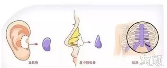 https://img.miyanlife.com/mnt/timg/180703/125UV5N-7.jpg