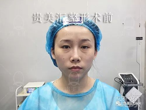 https://img.miyanlife.com/mnt/timg/180704/11400963U-2.jpg