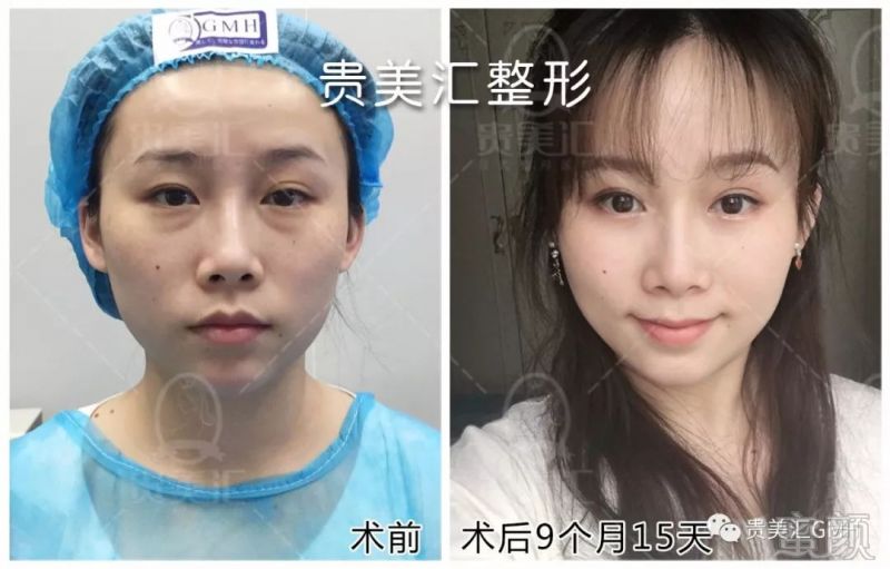 https://img.miyanlife.com/mnt/timg/180704/11400HF3-0.jpg