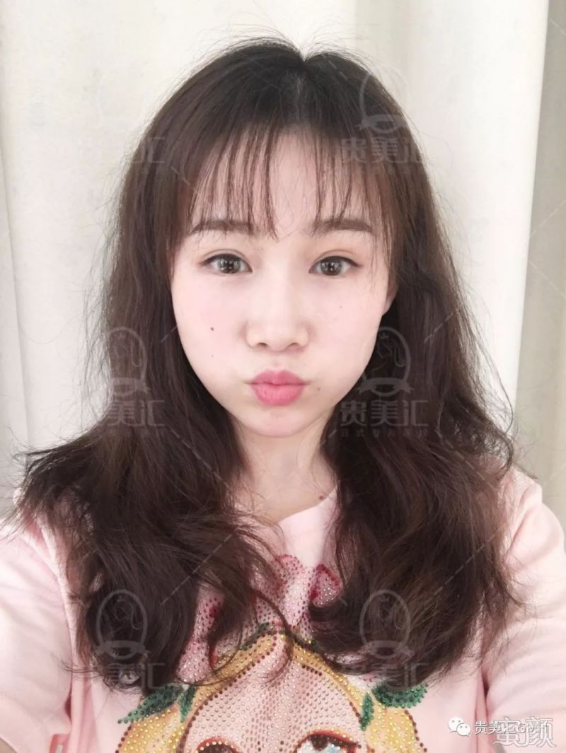 https://img.miyanlife.com/mnt/timg/180704/11400M126-1.jpg