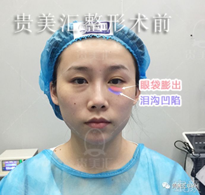 https://img.miyanlife.com/mnt/timg/180704/1140101363-3.jpg