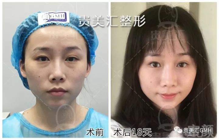 https://img.miyanlife.com/mnt/timg/180704/11401053Y-5.jpg