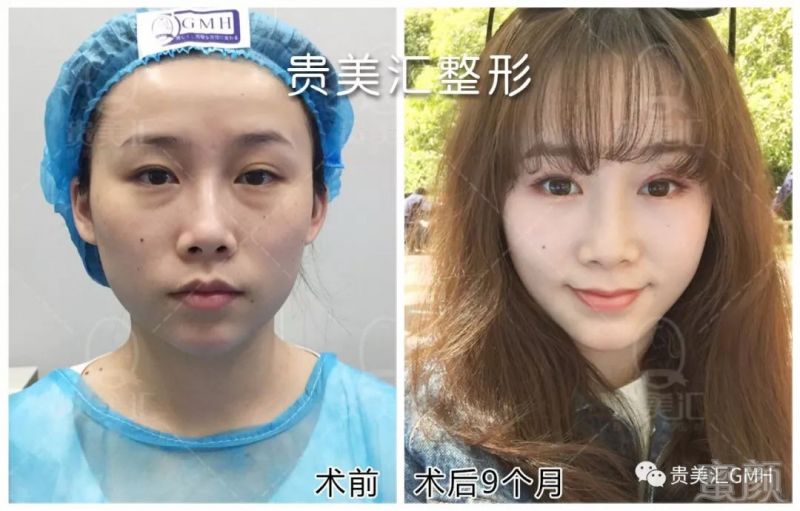 https://img.miyanlife.com/mnt/timg/180704/1140111433-8.jpg