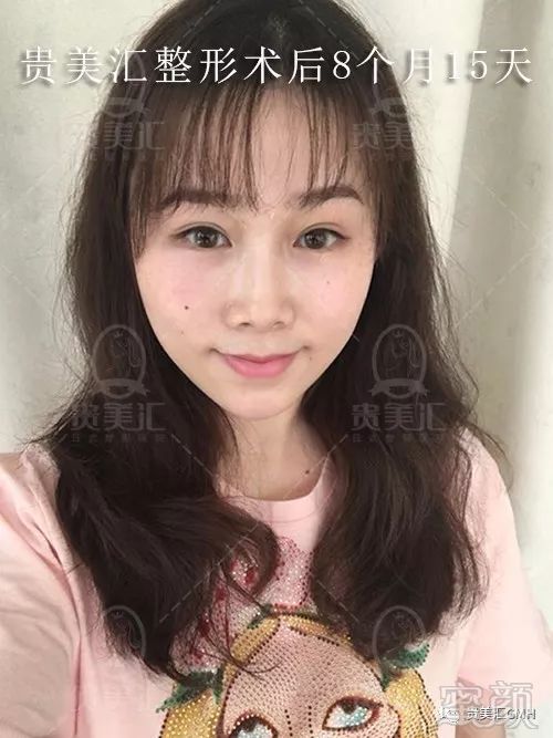 https://img.miyanlife.com/mnt/timg/180704/1140115939-7.jpg
