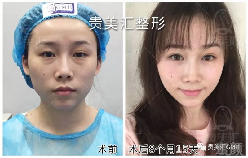 https://img.miyanlife.com/mnt/timg/180704/11401163X-6.jpg