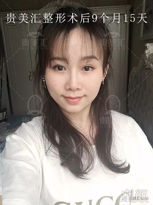 https://img.miyanlife.com/mnt/timg/180704/11401232a-11.jpg