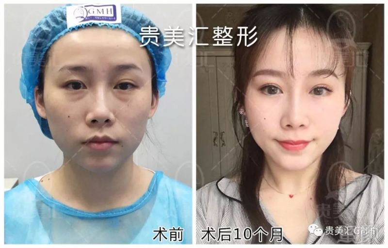 https://img.miyanlife.com/mnt/timg/180704/11401341X-12.jpg