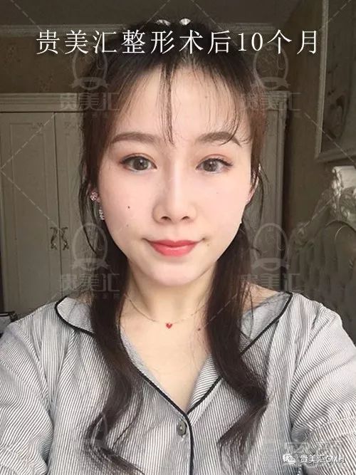 https://img.miyanlife.com/mnt/timg/180704/1140135329-13.jpg