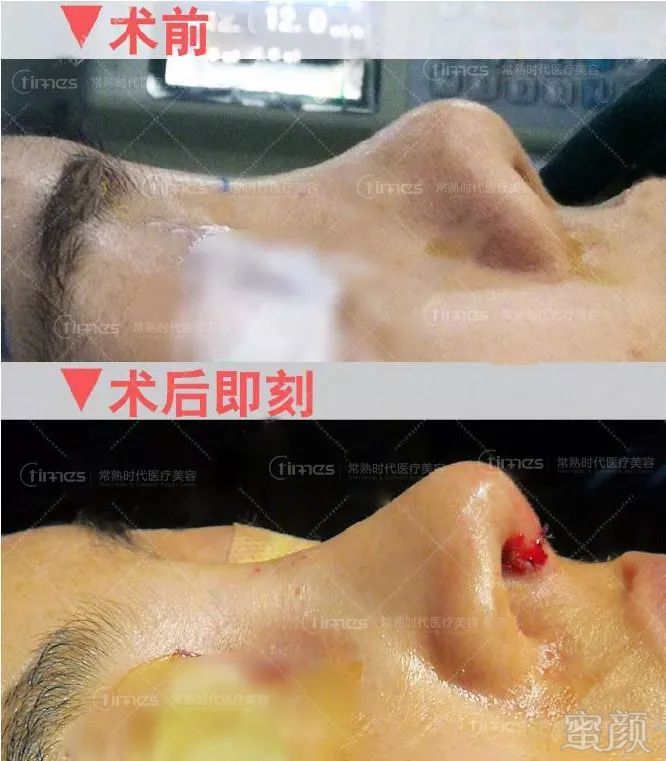 https://img.miyanlife.com/mnt/timg/180704/11452K257-6.jpg