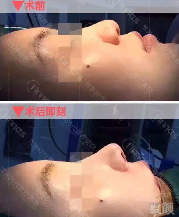 https://img.miyanlife.com/mnt/timg/180704/11452S537-8.jpg